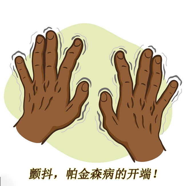 顫抖，帕金森病的開(kāi)端 帕金森的早期癥狀