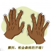 顫抖，帕金森病的開端 帕金森的癥狀有哪些